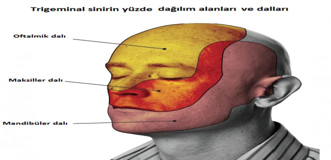 trigeminal-nevralji-tutulum-alanlari.png